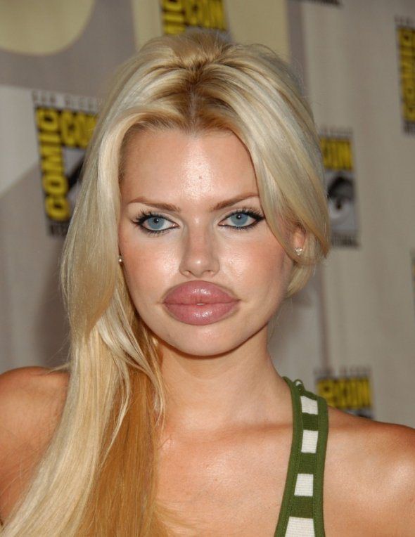 0dfa5c46f667526274e2da1ef5652e58--lip-injections-duckface-1590606248.jpg